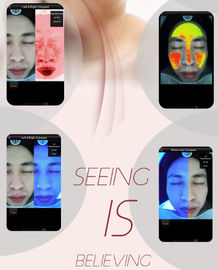 Exactement analyseur facial de peau d'analyse pour médecins Clinic Salon