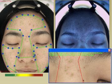 Les cosmétiques utilisant 3D rident la machine d'analyse RVB + UV + des spectres de PL 3