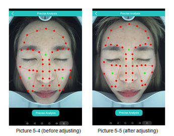 Nuage puissant de machine d'analyse de peau de 3D Digital partageant le logiciel d'Android