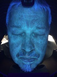 Analyseur professionnel d'hydratation de peau de la ride 3D avec le pixel de 18 Megapixel