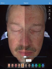 L'analyseur de peau de visage pour le visage de clinique s'care-testent, analyseur facial de peau