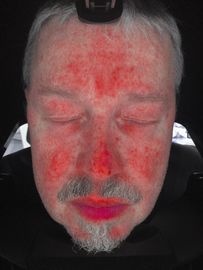 Analyse faciale de scanner de peau, machine d'analyseur de peau avec le certificat de la CE