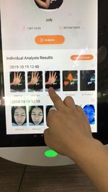 Stockage facial de Digital 64gb de système d'analyse de la Corée pour docteur Clinic