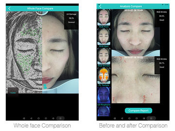 Problème intelligent de l'analyseur 12skin de peau détecté avec la Tablette 20 millions de pixels
