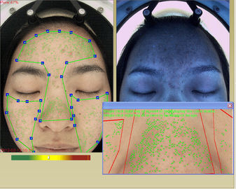 Machine faciale professionnelle d'analyseur d'hydratation de la peau 3d avec l'écran tactile