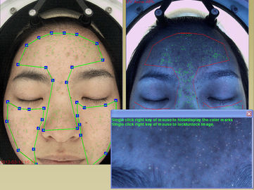 La FCC de pixels de la caméra 20Mega de visage d'analyseur d'humidité délivrent un certificat