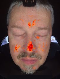 appareil de contrôle magique de miroir d'analyseur de peau de 3D Digital pour la clinique cosmétique de thérapeute
