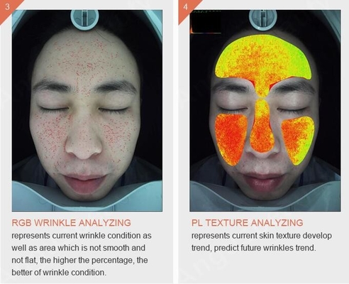 Machine sans fil tenue dans la main Digital d'analyse de peau de Wifi 3d avec le microscope visuel