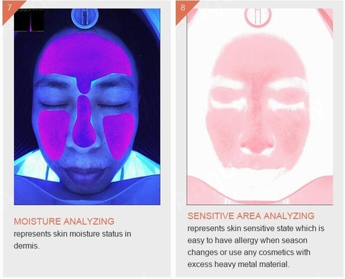 Jeux-concours futés de la machine 3D d'analyseur de peau d'acné de pigmentation de ride de soins de la peau