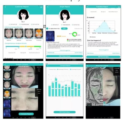 Caméra faciale de peau d'analyseur professionnel d'hydratation écran 20MP de 10,4 pouces