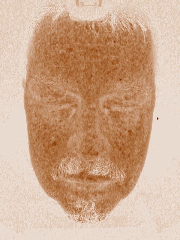 Système d'analyse de scanner de peau de la haute définition 5d, analyseur de peau sensible pour la station thermale de Salone