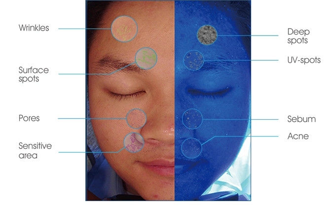 copie futée de pdf de machine d'analyseur de peau de la puissance 45W pour le salon de docteur beauté