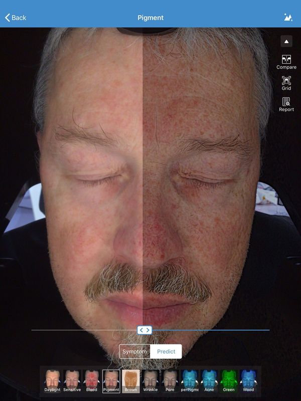 Stockage facial de Visia 32gb de scanner d'analyseur de la peau 3d pour docteur Skin Clinic